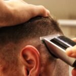 Haartransplantation in Deutschland: Ablauf und Vorteile gegenüber Auslandsbehandlungen verständlich erklärt